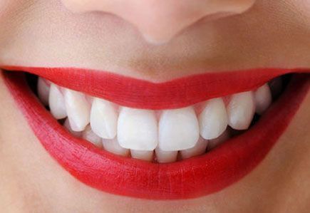 Antalya ästhetische Zahnheilkunde